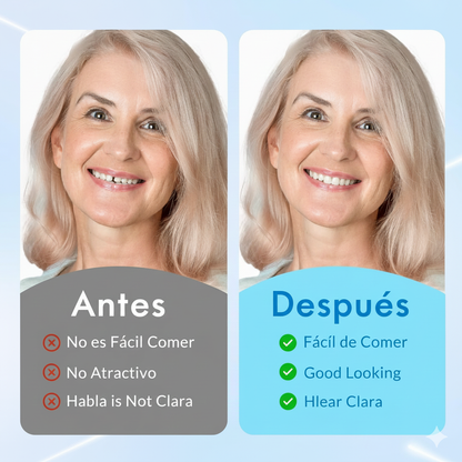 Fine Smile l Dentaduras con ajuste para una sonrisa natural y segura.